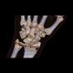 3D Rekonstruktion des knöchernen Handgelenks