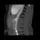CT-Angiographie Bauchgefäße
