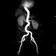 MR Angiographie der Aorta