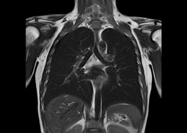 Radiologie & MRT Hamburg – professionelle Betreuung von Anfang an