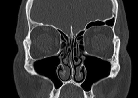 Zentrum für Innovative Radiologie | Computertomographie CT